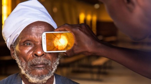 smartphone, medicine, eye, opthemology, africa, doctor, surgeon, 