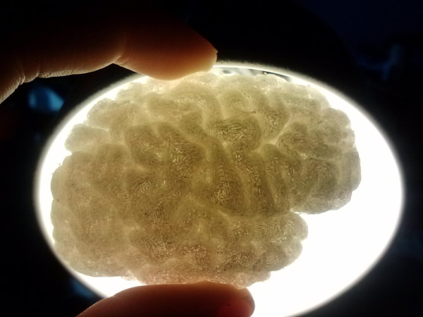 mri, brain, scan, stl, 3d printing, print