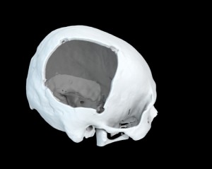 GuoSkull-opening-small