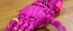Isabella-3dprinting-prosthetic-1