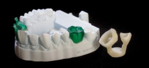 visijet-ftx-green-model-and-waxups_0